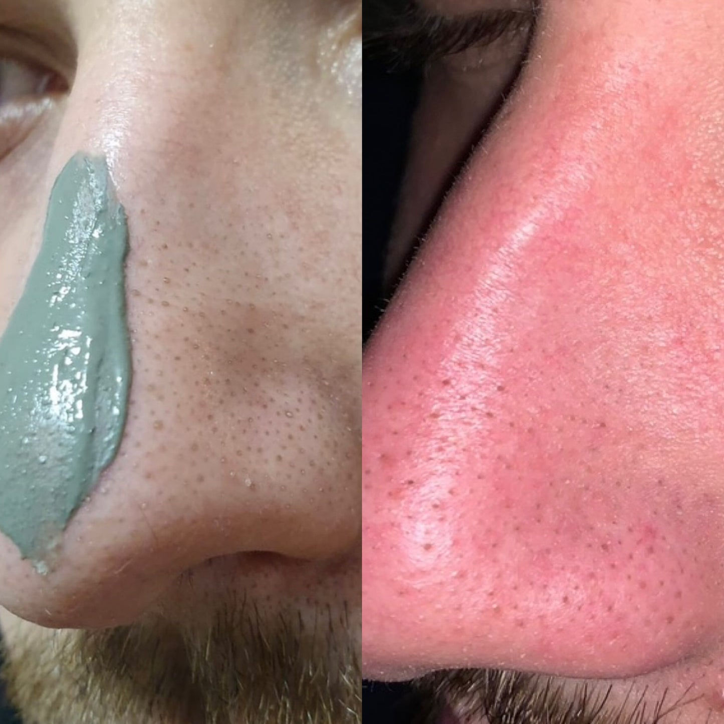 Green Beauty Gesichtsmaske